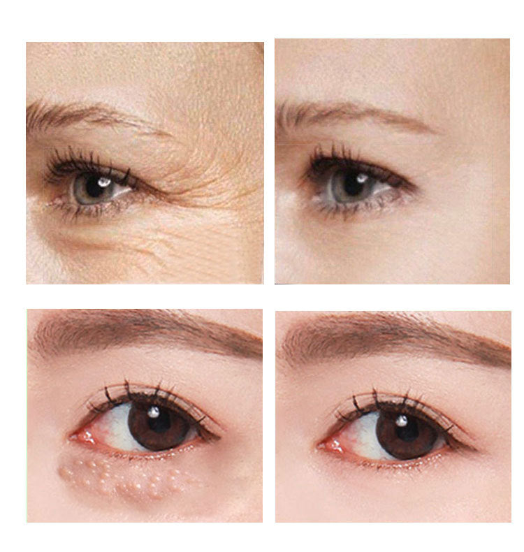 Retinol-Augencreme – Strahlende, glatte und erfrischte Augen